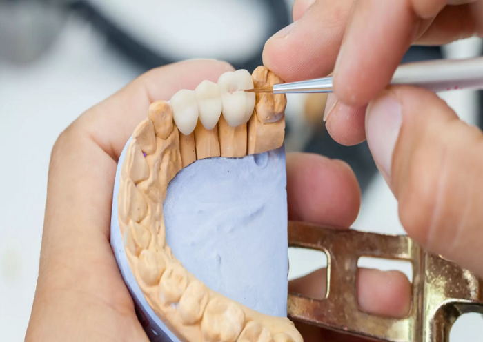 7 proven PPC strategies for dentists